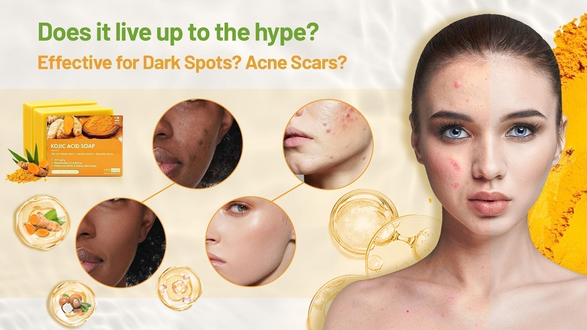 ARHGOAT Turmeric Kojic Acid Soap For Dark Spots, Acne Scars