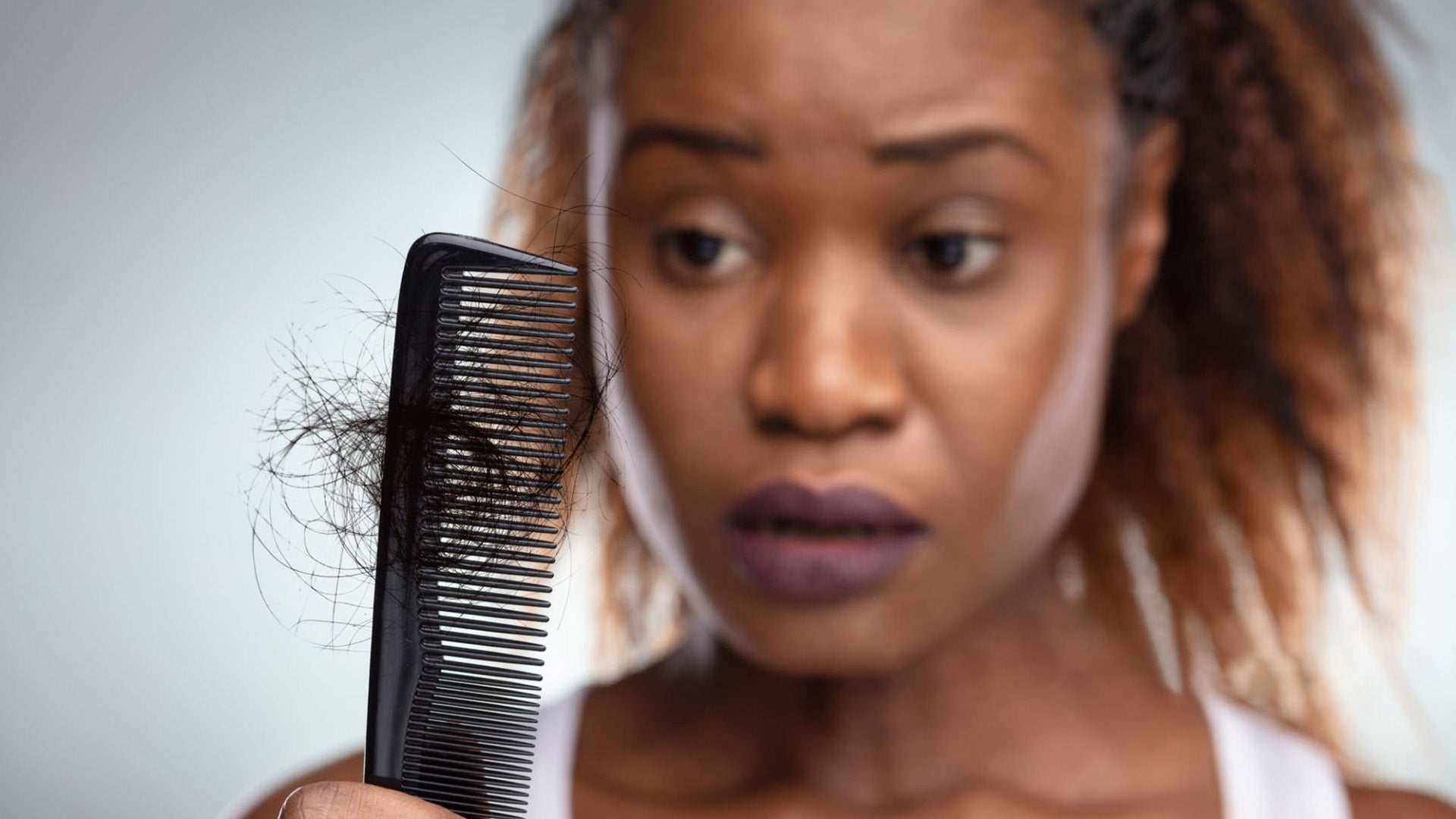 ARHGOAT - What is Hair Loss