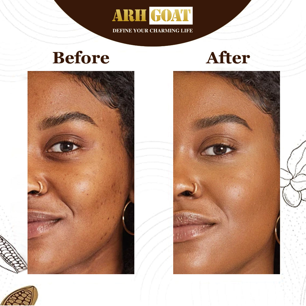 ARHGOAT African Black Soap - Before & After Results