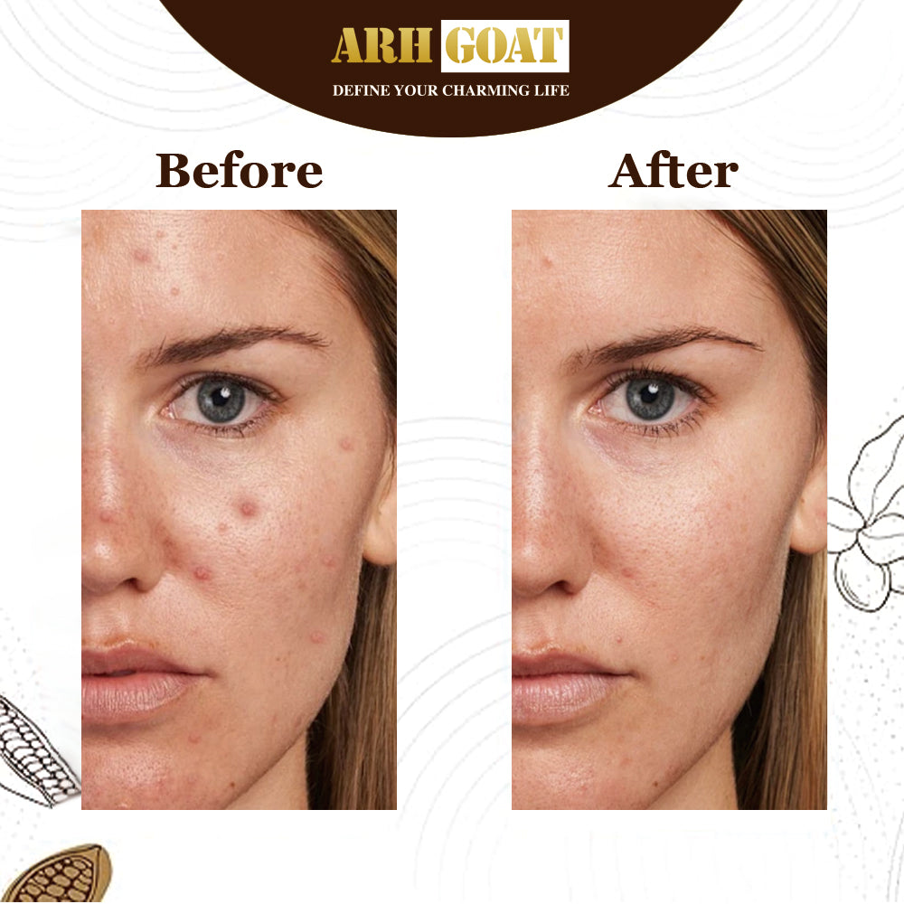 ARHGOAT African Black Soap - Before & After Results
