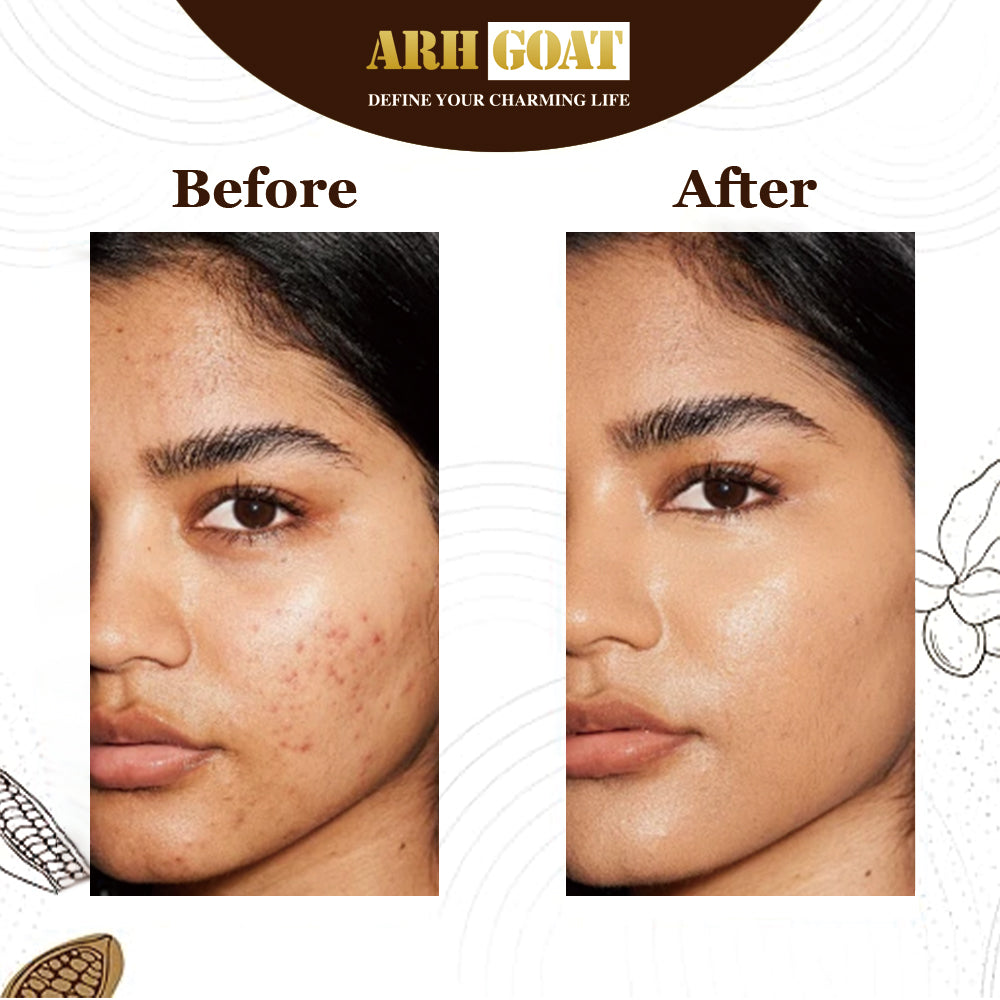 ARHGOAT African Black Soap - Before & After Results