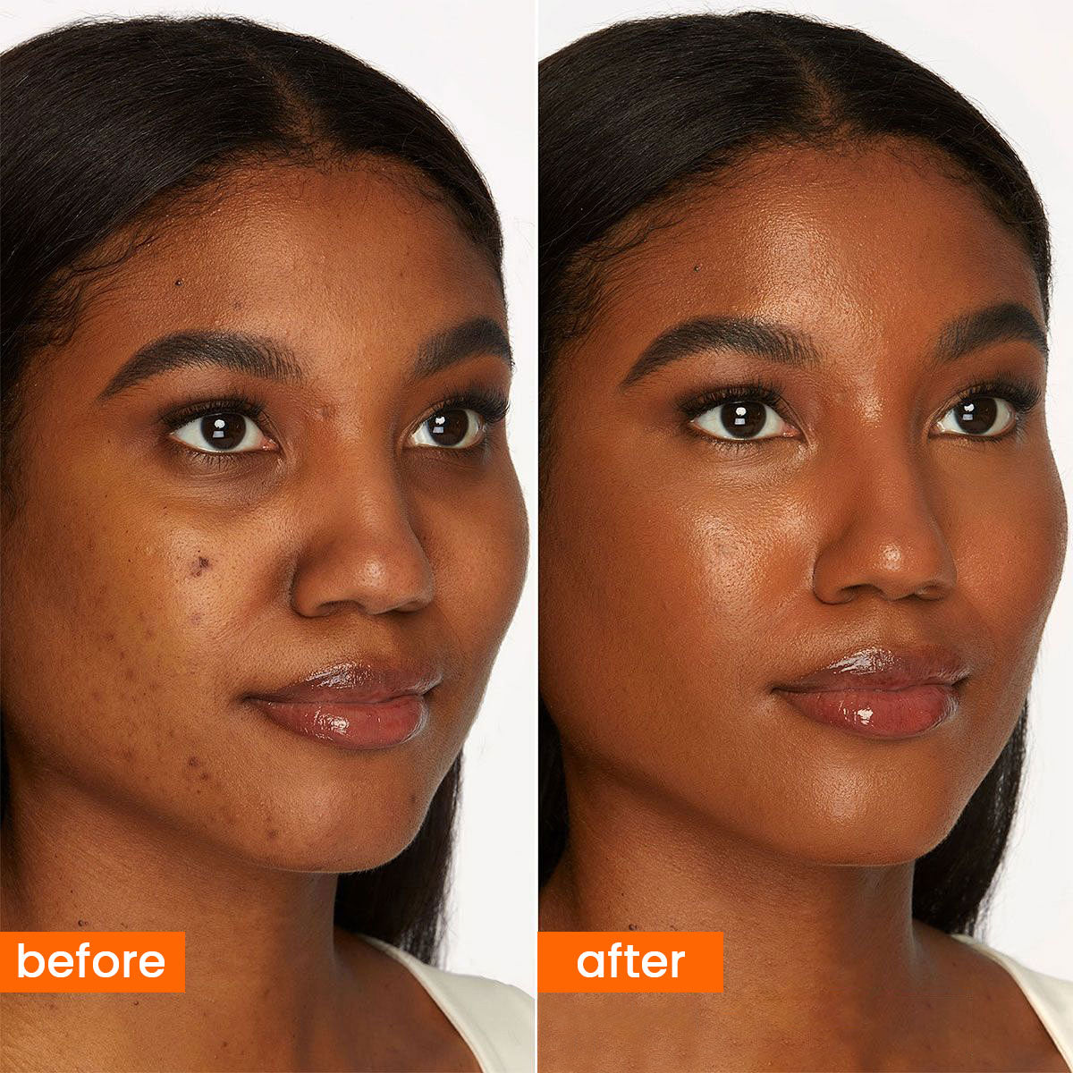 ARHGOAT Carrot Kojic Acid Soap 7oz/200g - BEFOR & AFTER RESULTS