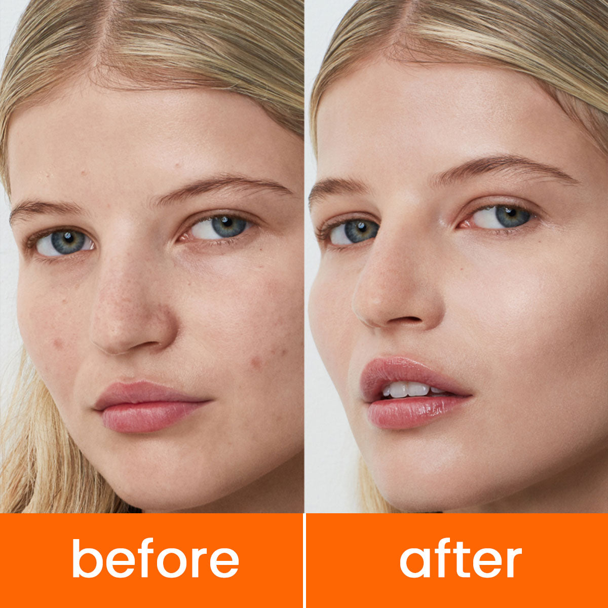 ARHGOAT Carrot Kojic Acid Soap 7oz/200g - BEFOR & AFTER RESULTS