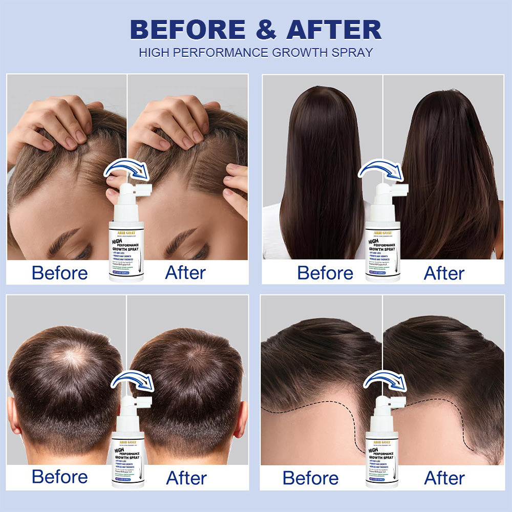 ARHGOAT Hair Growth Spray 60ml - Before & After Results