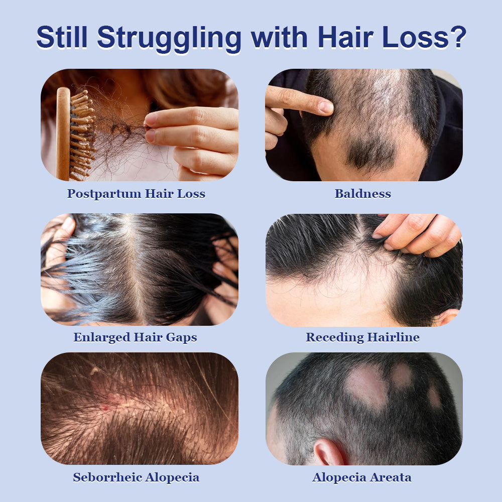 ARHGOAT Hair Growth Spray 60ml - For Hair Loss Problems