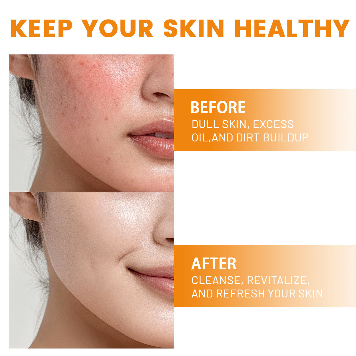 ARHGOAT Papaya Kojic Acid Soap - BEFORE & AFTER RESULTS