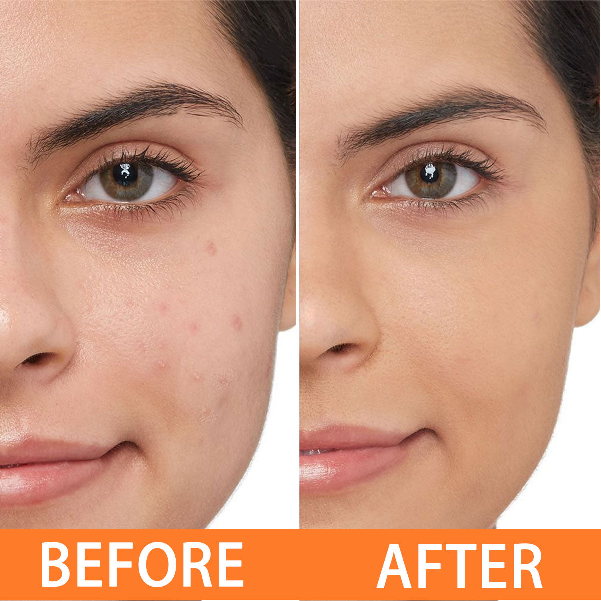 ARHGOAT Papaya Kojic Acid Soap - BEFORE & AFTER RESULTS