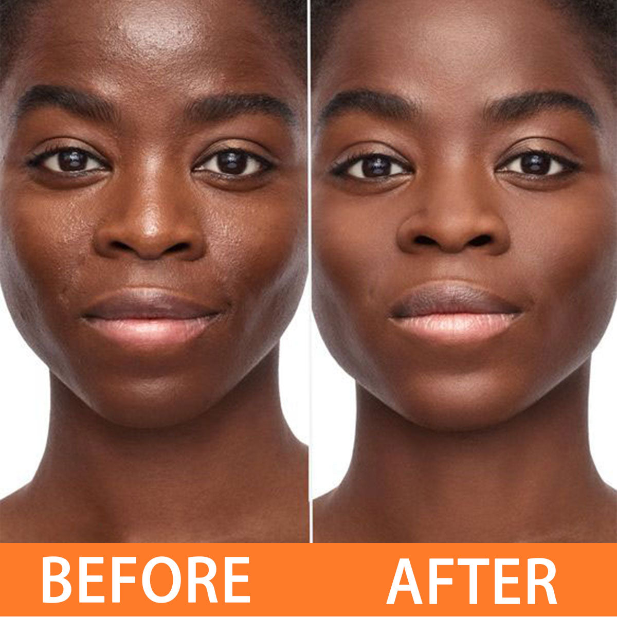 ARHGOAT Papaya Kojic Acid Soap - BEFORE & AFTER RESULTS