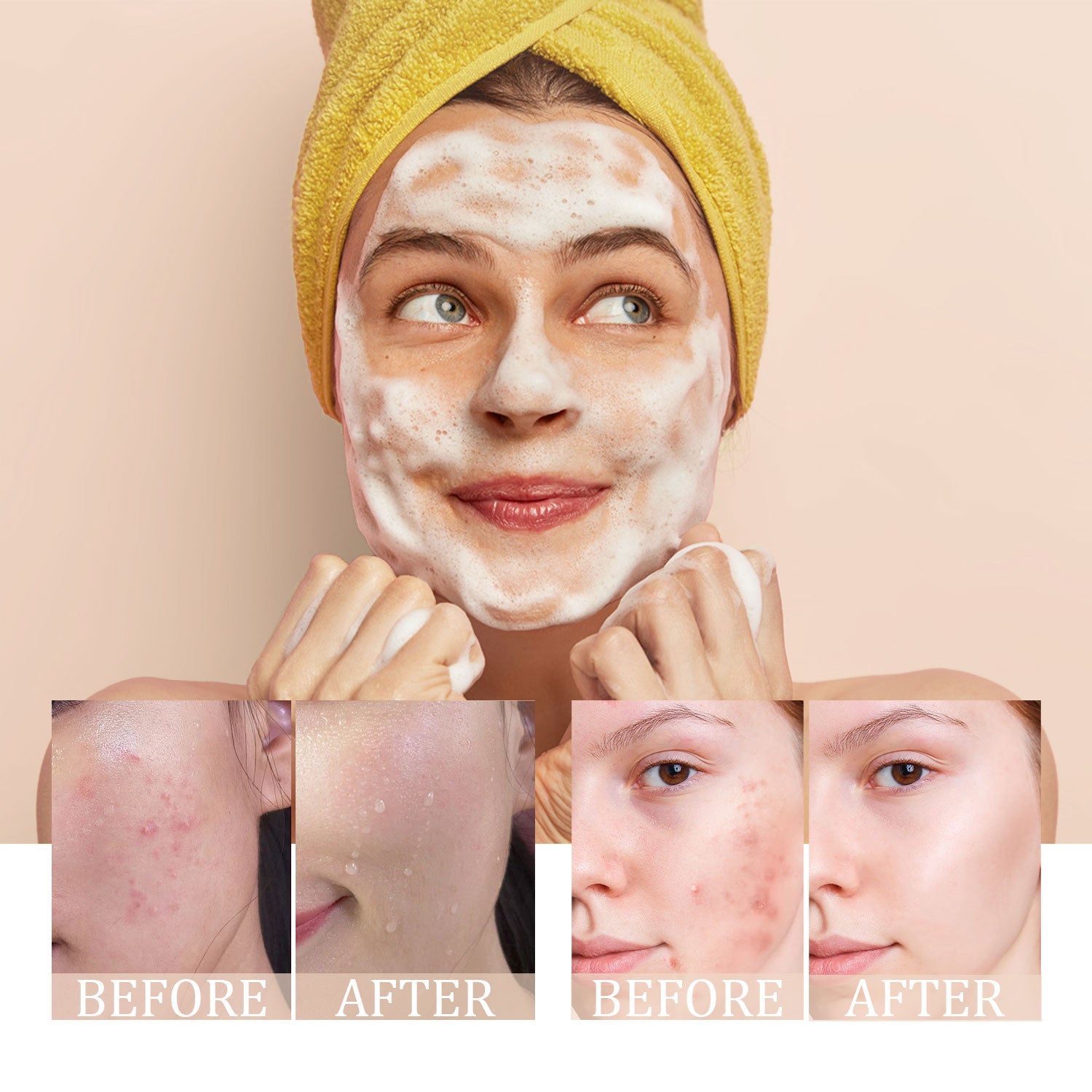 ARHGOAT Turmeric Facial Cleanser Foaming Face Wash 100ml - Before & After Results
