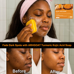 ARHGOAT Turmeric Kojic Acid Soap For Dark Spots, Before & After Results