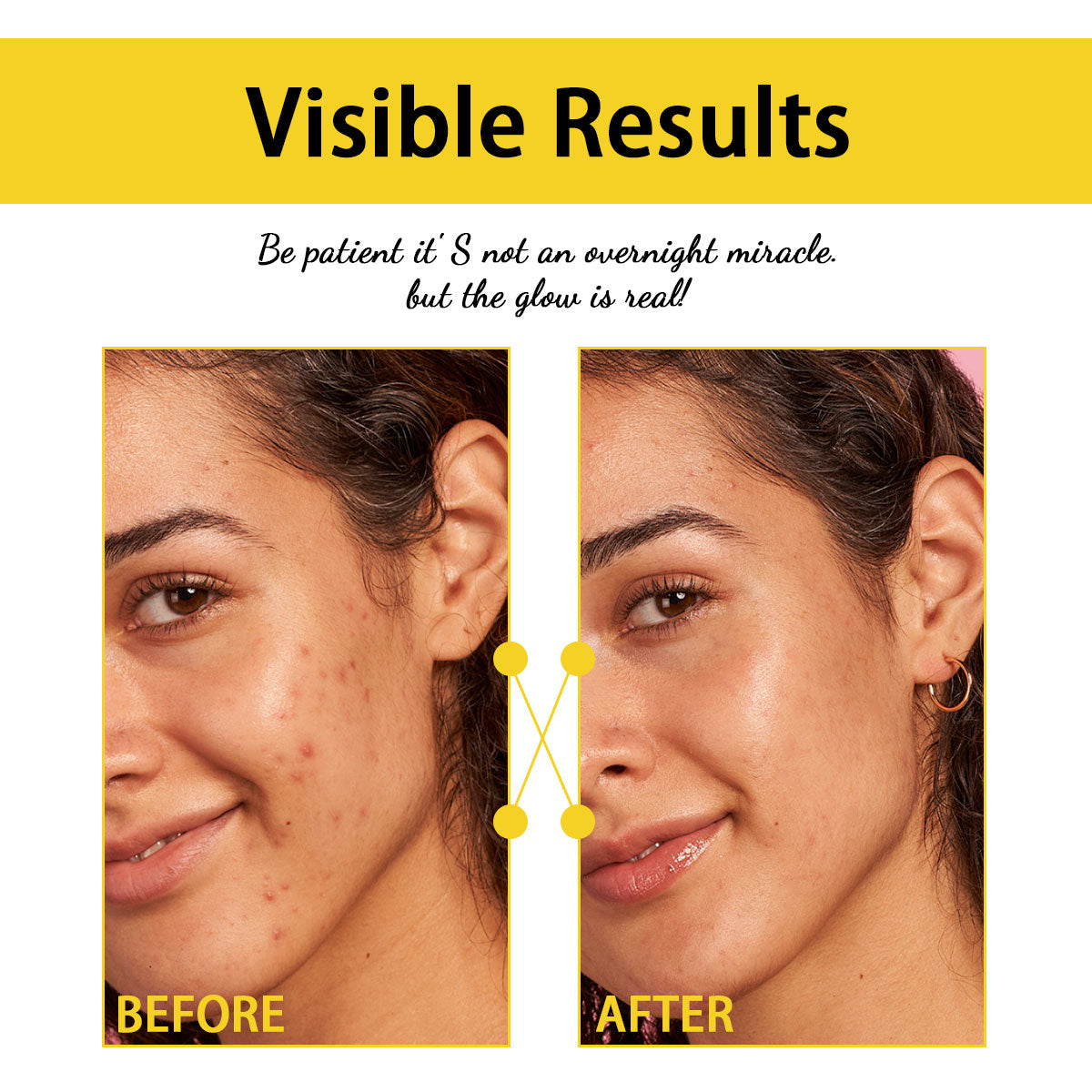 ARHGOAT Vitamin C Kojic Acid Soap 7oz/200g - BEFORE & AFTER RESULTS