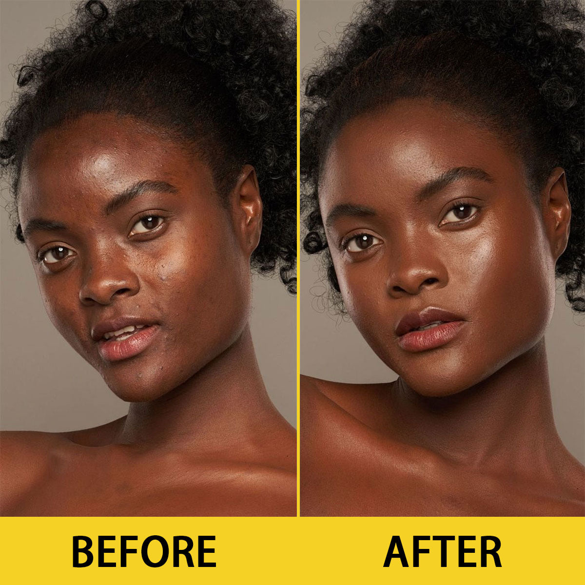 ARHGOAT Vitamin C Kojic Acid Soap 7oz/200g - BEFORE & AFTER RESULTS