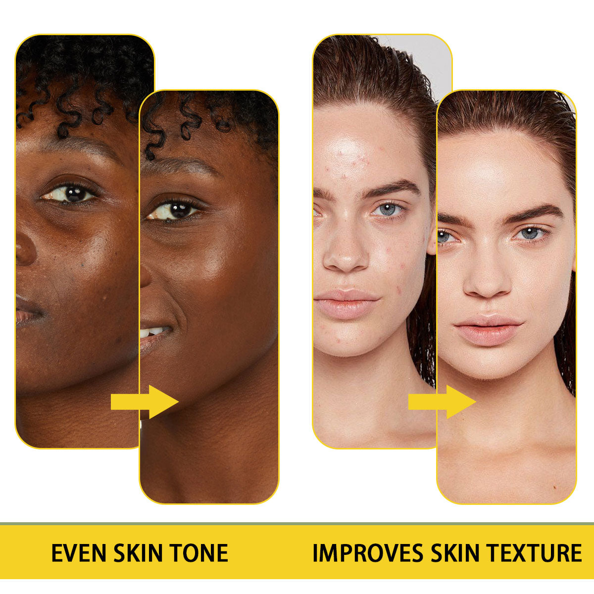 ARHGOAT Vitamin C Kojic Acid Soap 7oz/200g - Even Skin Tones